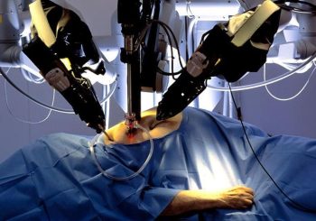 नारायणी हस्पिटलमा चाडै रोबट सर्जरी