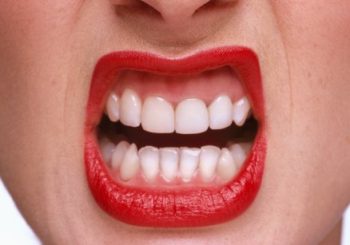 कसरी रोक्ने सास गन्हाउने समस्या ?