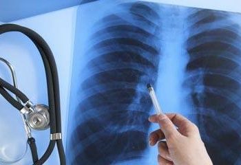 फोक्सोको क्यान्सर भइहाले के गर्ने ?