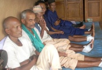 कुष्ठरोगका कारण ३० हजार अंगभंग