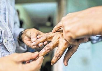 नेपालगन्जमा कुष्ठरोगी भेटिए