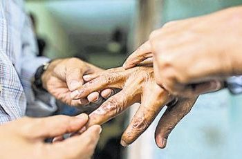 कुष्ठरोगीको सम्पूर्ण उपचार निःशुल्क–सिरहामा ७९ कुष्ठरोगी फेला