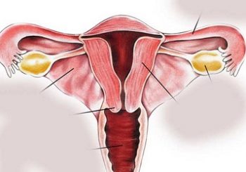 स्वास्थ्य परीक्षण गराएका ४४५ महिलामध्ये ३५ जनाको पाठेघर शल्यक्रिया गर्नुपर्ने