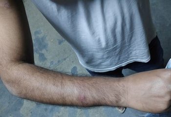 ड्युटी सकेर फर्कदै गरेका त्रिवि शिक्षण अस्पतालका डाक्टरमाथि प्रहरीको कुटपिट